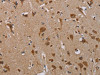 The image on the left is immunohistochemistry of paraffin-embedded Human brain tissue using CSB-PA057327 (PARP3 Antibody) at dilution 1/20, on the right is treated with synthetic peptide. (Original magnification: ×200)