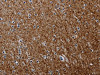 The image on the left is immunohistochemistry of paraffin-embedded Human brain tissue using CSB-PA169703 (PCDHAC1 Antibody) at dilution 1/50, on the right is treated with synthetic peptide. (Original magnification: ×200)