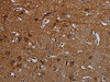 The image on the left is immunohistochemistry of paraffin-embedded Human brain tissue using CSB-PA115469 (PCDHB15 Antibody) at dilution 1/50, on the right is treated with synthetic peptide. (Original magnification: ×200)