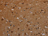 The image on the left is immunohistochemistry of paraffin-embedded Human brain tissue using CSB-PA494141 (PCDHB15 Antibody) at dilution 1/50, on the right is treated with synthetic peptide. (Original magnification: ×200)