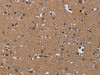 The image on the left is immunohistochemistry of paraffin-embedded Human brain tissue using CSB-PA295171 (PDE4A Antibody) at dilution 1/40, on the right is treated with synthetic peptide. (Original magnification: ×200)