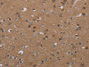 The image on the left is immunohistochemistry of paraffin-embedded Human brain tissue using CSB-PA108491 (PDGFC Antibody) at dilution 1/40, on the right is treated with synthetic peptide. (Original magnification: ×200)