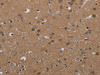 The image on the left is immunohistochemistry of paraffin-embedded Human brain tissue using CSB-PA108491 (PDGFC Antibody) at dilution 1/40, on the right is treated with synthetic peptide. (Original magnification: ×200)