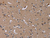 The image on the left is immunohistochemistry of paraffin-embedded Human brain tissue using CSB-PA146607 (PDGFC Antibody) at dilution 1/40, on the right is treated with synthetic peptide. (Original magnification: ×200)