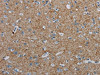 The image on the left is immunohistochemistry of paraffin-embedded Human brain tissue using CSB-PA281298 (PGLYRP1 Antibody) at dilution 1/40, on the right is treated with synthetic peptide. (Original magnification: ×200)