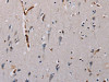 The image on the left is immunohistochemistry of paraffin-embedded Human brain tissue using CSB-PA697082 (PLCB3 Antibody) at dilution 1/40, on the right is treated with synthetic peptide. (Original magnification: ×200)