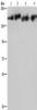 Gel: 6%SDS-PAGE, Lysate: 40 μg, Lane 1-4: PC3 cells, A431 cells, mouse lung tissue, Hela cells, Primary antibody: CSB-PA697082 (PLCB3 Antibody) at dilution 1/200, Secondary antibody: Goat anti rabbit IgG at 1/8000 dilution, Exposure time: 3 minutes