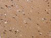 The image on the left is immunohistochemistry of paraffin-embedded Human brain tissue using CSB-PA226742 (PLXNA4 Antibody) at dilution 1/50, on the right is treated with synthetic peptide. (Original magnification: ×200)