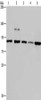 Gel: 6%SDS-PAGE, Lysate: 40 μg, Lane 1-5: Jurkat cells, Hela cells, A431 cells, mouse liver tissue tissue, 293T cells, Primary antibody: CSB-PA796358 (PNPT1 Antibody) at dilution 1/200, Secondary antibody: Goat anti rabbit IgG at 1/8000 dilution, Exposure time: 2 minutes