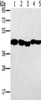 Gel: 8%SDS-PAGE, Lysate: 40 μg, Lane 1-5: Hela cells, skov3 cells, A549 cells, mouse liver tissue, human ovarian cancer tissue, Primary antibody: CSB-PA927936 (PON1 Antibody) at dilution 1/500, Secondary antibody: Goat anti rabbit IgG at 1/8000 dilution, Exposure time: 20 seconds