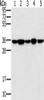 Gel: 10%SDS-PAGE, Lysate: 40 μg, Lane 1-5: Jurkat cells, 293T cells, hela cells, mouse brain tissue, K562 cells, Primary antibody: CSB-PA251592 (PPP1CC Antibody) at dilution 1/200, Secondary antibody: Goat anti rabbit IgG at 1/8000 dilution, Exposure time: 1 second