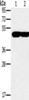 Gel: 8%SDS-PAGE, Lysate: 40 μg, Lane 1-2: K562 cells, 293T cells, Primary antibody: CSB-PA121495 (PPOX Antibody) at dilution 1/200, Secondary antibody: Goat anti rabbit IgG at 1/8000 dilution, Exposure time: 30 seconds