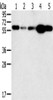 Gel: 10%SDS-PAGE, Lysate: 40 μg, Lane 1-5: Hela cells, Jurkat cells, mouse lung tissue, PC3 cells, mouse liver tissue, Primary antibody: CSB-PA546249 (PTGER2 Antibody) at dilution 1/200, Secondary antibody: Goat anti rabbit IgG at 1/8000 dilution, Exposure time: 30 seconds