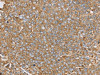 The image on the left is immunohistochemistry of paraffin-embedded Human ovarian cancer tissue using CSB-PA928051 (PTGER2 Antibody) at dilution 1/45, on the right is treated with synthetic peptide. (Original magnification: ×200)