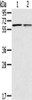 Gel: 10%SDS-PAGE, Lysate: 40 μg, Lane 1-2: Mouse liver tissue, Mouse lung tissue, Primary antibody: CSB-PA928051 (PTGER2 Antibody) at dilution 1/200, Secondary antibody: Goat anti rabbit IgG at 1/8000 dilution, Exposure time: 10 seconds