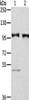 Gel: 6%SDS-PAGE, Lysate: 40 μg, Lane 1-2: Human fetal liver tissue, 231 cells, Primary antibody: CSB-PA215840 (PROX1 Antibody) at dilution 1/300 dilution, Secondary antibody: Goat anti rabbit IgG at 1/8000 dilution, Exposure time: 2 minutes