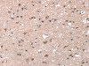 The image on the left is immunohistochemistry of paraffin-embedded Human brain tissue using CSB-PA943456 (PRSS8 Antibody) at dilution 1/45, on the right is treated with synthetic peptide. (Original magnification: ×200)