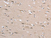 The image on the left is immunohistochemistry of paraffin-embedded Human brain tissue using CSB-PA151388 (DLG2 Antibody) at dilution 1/35, on the right is treated with synthetic peptide. (Original magnification: ×200)