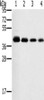 Gel: 10%SDS-PAGE, Lysate: 40 μg, Lane 1-4: 293T cells, A549 cells, hela cells, PC3 cells, Primary antibody: CSB-PA293886 (PTGER1 Antibody) at dilution 1/200, Secondary antibody: Goat anti rabbit IgG at 1/8000 dilution, Exposure time: 10 seconds