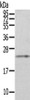 Gel: 6%SDS-PAGE, Lysate: 40 μg, , Primary antibody: CSB-PA790236 (RAB8A Antibody) at dilution 1/200 dilution, Secondary antibody: Goat anti rabbit IgG at 1/8000 dilution, Exposure time: 40 seconds