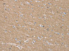 The image on the left is immunohistochemistry of paraffin-embedded Human brain tissue using CSB-PA104885 (TFRC Antibody) at dilution 1/35, on the right is treated with synthetic peptide. (Original magnification: ×200)