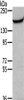 Gel: 6%SDS-PAGE, Lysate: 40 μg, , Primary antibody: CSB-PA692815 (MUC1 Antibody) at dilution 1/200 dilution, Secondary antibody: Goat anti rabbit IgG at 1/8000 dilution, Exposure time: 5 minutes