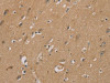 The image on the left is immunohistochemistry of paraffin-embedded Human brain tissue using CSB-PA248994 (RAD51 Antibody) at dilution 1/40, on the right is treated with synthetic peptide. (Original magnification: ×200)