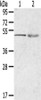 Gel: 8%SDS-PAGE, Lysate: 40 μg, Lane 1-2: 231 cells, Human breast infiltrative duct tissue, Primary antibody: CSB-PA123241 (RHCE Antibody) at dilution 1/200 dilution, Secondary antibody: Goat anti rabbit IgG at 1/8000 dilution, Exposure time: 1 minute