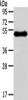 Gel: 8%SDS-PAGE, Lysate: 40 μg, , Primary antibody: CSB-PA093489 (RHCE Antibody) at dilution 1/250 dilution, Secondary antibody: Goat anti rabbit IgG at 1/8000 dilution, Exposure time: 5 minutes