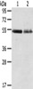 Gel: 8%SDS-PAGE, Lysate: 40 μg, Lane 1-2: Human placenta tissue, Human breast infiltrative duct tissue, Primary antibody: CSB-PA442653 (RHCG Antibody) at dilution 1/550 dilution, Secondary antibody: Goat anti rabbit IgG at 1/8000 dilution, Exposure time: 5 minutes