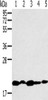 Gel: 10%SDS-PAGE, Lysate: 40 μg, Lane 1-5: K562 cells, 231 cells, Jurkat cells, hela cells, 293T cells, Primary antibody: CSB-PA034142 (RNF5 Antibody) at dilution 1/200, Secondary antibody: Goat anti rabbit IgG at 1/8000 dilution, Exposure time: 3 minutes