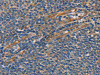 The image on the left is immunohistochemistry of paraffin-embedded Human tonsil tissue using CSB-PA894571 (SLC39A7 Antibody) at dilution 1/25, on the right is treated with synthetic peptide. (Original magnification: ×200)