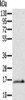 Gel: 12%SDS-PAGE, Lysate: 40 μg, Lane: Mouse skin tissue, Primary antibody: CSB-PA983699 (Ly6a Antibody) at dilution 1/200, Secondary antibody: Goat anti rabbit IgG at 1/8000 dilution, Exposure time: 2 minutes