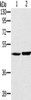 Gel: 8%SDS-PAGE, Lysate: 40 μg, Lane 1-2: Human fetal liver tissue, mouse liver tissue, Primary antibody: CSB-PA091643 (SEC14L2 Antibody) at dilution 1/300, Secondary antibody: Goat anti rabbit IgG at 1/8000 dilution, Exposure time: 5 minutes
