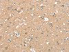 The image on the left is immunohistochemistry of paraffin-embedded Human brain tissue using CSB-PA183005 (SEPN1 Antibody) at dilution 1/20, on the right is treated with synthetic peptide. (Original magnification: ×200)