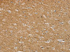 The image on the left is immunohistochemistry of paraffin-embedded Human brain tissue using CSB-PA128984 (SENP3 Antibody) at dilution 1/35, on the right is treated with synthetic peptide. (Original magnification: ×200)