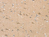 The image on the left is immunohistochemistry of paraffin-embedded Human brain tissue using CSB-PA088132 (SGPL1 Antibody) at dilution 1/25, on the right is treated with synthetic peptide. (Original magnification: ×200)