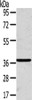 Gel: 8%SDS-PAGE, Lysate: 40 μg, , Primary antibody: CSB-PA251777 (SLC25A20 Antibody) at dilution 1/200 dilution, Secondary antibody: Goat anti rabbit IgG at 1/8000 dilution, Exposure time: 1 minute