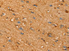 The image on the left is immunohistochemistry of paraffin-embedded Human brain tissue using CSB-PA980760 (SLC25A4 Antibody) at dilution 1/30, on the right is treated with synthetic peptide. (Original magnification: ×200)