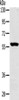 Gel: 6%SDS-PAGE, Lysate: 40 μg, Lane: Hepg2 cells, Primary antibody: CSB-PA900358 (SLC39A5 Antibody) at dilution 1/200, Secondary antibody: Goat anti rabbit IgG at 1/8000 dilution, Exposure time: 1 minute