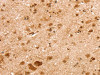 The image on the left is immunohistochemistry of paraffin-embedded Human brain tissue using CSB-PA991288 (SNX30 Antibody) at dilution 1/35, on the right is treated with synthetic peptide. (Original magnification: ×200)