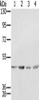 Gel: 8%SDS-PAGE, Lysate: 40 μg, Lane 1-4: K562 cells, 231 cells, Raji cells, hela cells, Primary antibody: CSB-PA127171 (SSB Antibody) at dilution 1/400, Secondary antibody: Goat anti rabbit IgG at 1/8000 dilution, Exposure time: 10 seconds