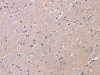 The image on the left is immunohistochemistry of paraffin-embedded Human brain tissue using CSB-PA964419 (KCNK3 Antibody) at dilution 1/20, on the right is treated with synthetic peptide. (Original magnification: ×200)