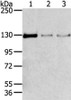 Gel: 6%SDS-PAGE, Lysate: 80 μg, Lane 1-3: 293T, 231 and lo2 cell, Primary antibody: CSB-PA197772 (TRIM24 Antibody) at dilution 1/400 dilution, Secondary antibody: Goat anti rabbit IgG at 1/8000 dilution, Exposure time: 1 minute