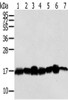 Gel: 12%SDS-PAGE, Lysate: 40 μg, Lane 1-7: Hela cells, NIH/3T3 cells, LNCap cells, 293T cells, Mouse brain tissue, A549 cells, Jurkat cells, Primary antibody: CSB-PA129185 (NME2 Antibody) at dilution 1/300 dilution, Secondary antibody: Goat anti rabbit IgG at 1/8000 dilution, Exposure time: 30 seconds