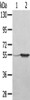 Gel: 8%SDS-PAGE, Lysate: 40 μg, Lane 1-2: A375 cells, human fetal muscle tissue, Primary antibody: CSB-PA192313 (TRIM35 Antibody) at dilution 1/550, Secondary antibody: Goat anti rabbit IgG at 1/8000 dilution, Exposure time: 5 seconds