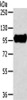 Gel: 6%SDS-PAGE, Lysate: 40 μg, , Primary antibody: CSB-PA173135 (TRIM71 Antibody) at dilution 1/300 dilution, Secondary antibody: Goat anti rabbit IgG at 1/8000 dilution, Exposure time: 20 seconds