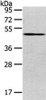 Gel: 8%SDS-PAGE, Lysate: 80 μg, Lane: 293T cell, Primary antibody: CSB-PA292260 (VMP1 Antibody) at dilution 1/800 dilution, Secondary antibody: Goat anti rabbit IgG at 1/8000 dilution, Exposure time: 1 minute