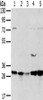 Gel: 8%SDS-PAGE, Lysate: 40 μg, Lane 1-5: 293T cells, MCF7 cells, mouse brain tissue, K562 cells, mouse bladder tissue, Primary antibody: CSB-PA291759 (TPD52L2 Antibody) at dilution 1/400, Secondary antibody: Goat anti rabbit IgG at 1/8000 dilution, Exposure time: 20 seconds