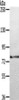 Gel: 6%SDS-PAGE, Lysate: 40 μg, Lane: Mouse eyes tissue, Primary antibody: CSB-PA219322 (TGM7 Antibody) at dilution 1/300, Secondary antibody: Goat anti rabbit IgG at 1/8000 dilution, Exposure time: 5 seconds